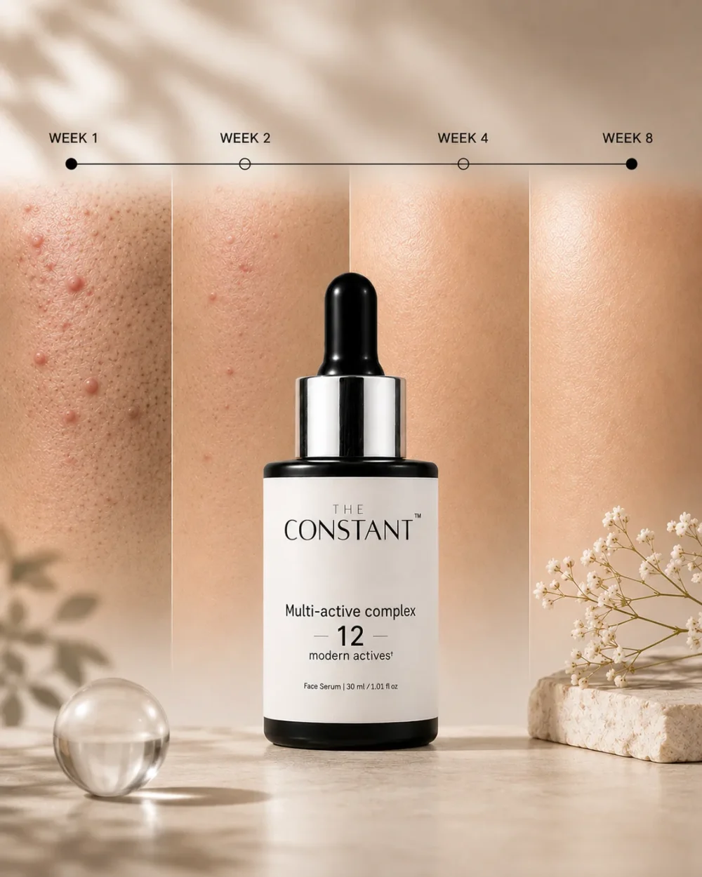 Multi-Active Complex Face Serum: Face Serum for Acne Marks, made for Indian skin